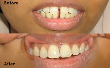cosmetic dentistry